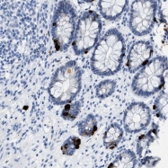 NBP1-86901 - WDR4