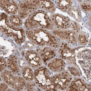 NBP1-85048 - WDR44 / Rabphilin-11