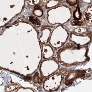 NBP1-83510 - WDR49