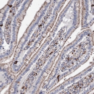 NBP1-92584 - WDR51B