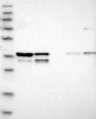 NBP1-92585 - WDR57 / SNRNP40 / PRP8BP