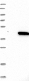 NBP1-92586 - WDR57 / SNRNP40 / PRP8BP