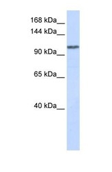 NBP1-56718 - WDR63