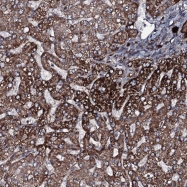NBP1-82711 - WDR66