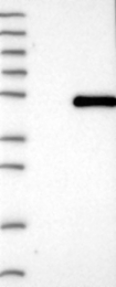 NBP1-84623 - WDR74