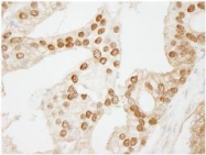 NB100-77305 - WDR77 / MEP-50