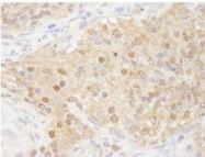 NB100-77305 - WDR77 / MEP-50