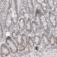 NBP1-92592 - WDR79 / TCAB1