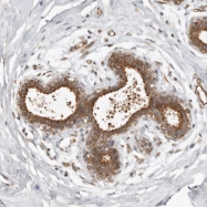 NBP1-86714 - WDR85