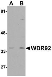 NBP1-76282 - WDR92 / Monad