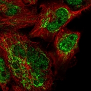 NBP1-90030 - ATPase WRNIP1