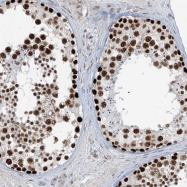 NBP1-90030 - ATPase WRNIP1