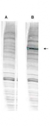 NBP1-77987 - ATPase WRNIP1