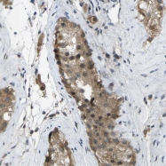 NBP1-82632 - WHSC1