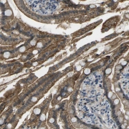 NBP1-82633 - WHSC1