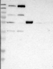 NBP1-82633 - WHSC1