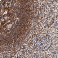 NBP1-86859 - WIPF1