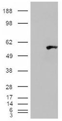 NB100-68147 - WIPF1