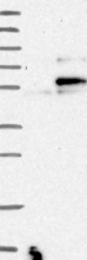 NBP1-88880 - WIPI-2