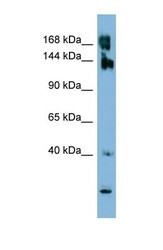 NBP1-58361 - WNK3