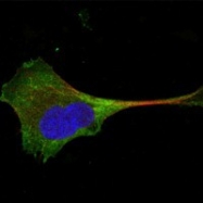 NBP1-47541 - WNT10B