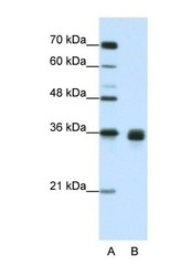 NBP1-53120 - WNT2B