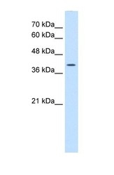 NBP1-53123 - WNT2B