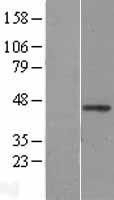 NBL1-17868 - WNT2B Lysate