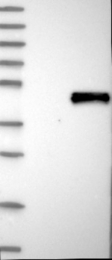 NBP1-86854 - WNT4