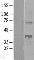 NBL1-17871 - WNT4 Lysate