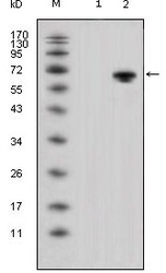 NBP1-47438 - WNT5A