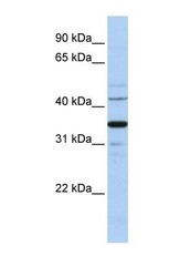 NBP1-60032 - WNT5A