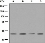 NBP1-95997 - WNT5B