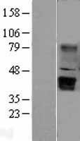 NBL1-17873 - WNT5B Lysate