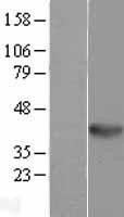 NBL1-17874 - WNT5B Lysate