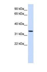 NBP1-62305 - WNT6