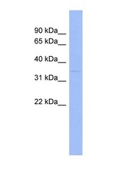 NBP1-59564 - WNT7B