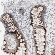 NBP1-86855 - WNT9A
