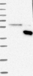 NBP1-86855 - WNT9A