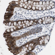 NBP1-81503 - WSCD1