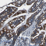 NBP1-93622 - WSCD2