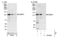 NBP1-49712 - WWP1