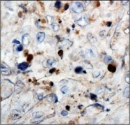 NB110-60011 - WT1 / Wilms tumor protein