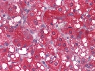NBP1-51575 - WNT1