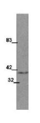 NBP1-42739 - WNT1