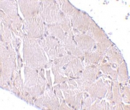 NBP1-76916 - WNT10A