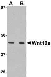 NBP1-76916 - WNT10A