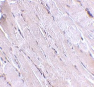 NBP1-77325 - WNT10B