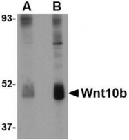 NBP1-77325 - WNT10B