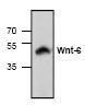 NBP1-45931 - WNT6